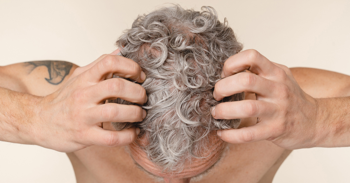 what causes hair loss Cellustrious male thinning