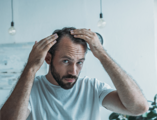 Anxiety, Stress and Hair Loss: Are They Related?