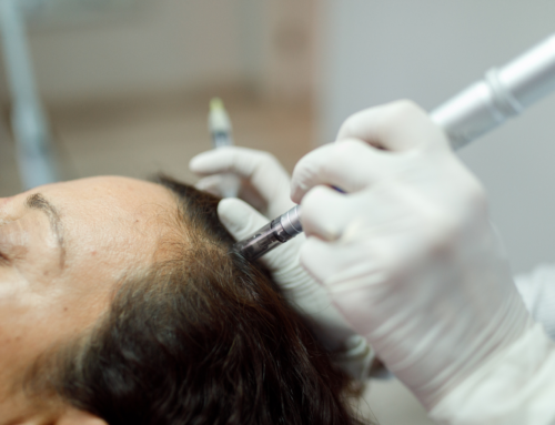 Unlocking the Secrets of Hair Regrowth: The Miraculous Benefits of Microneedling