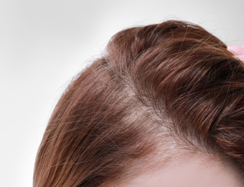 The Link Between Hair Extensions and Itchy Scalp