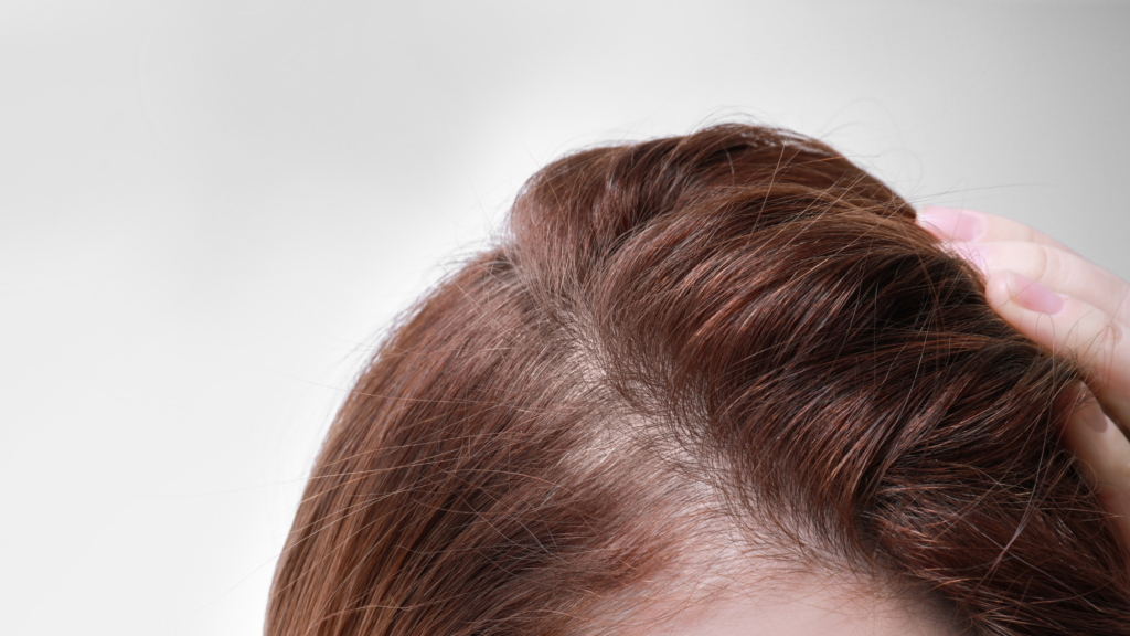 Can You Regrow Hair With Peptides? - Cellustrious